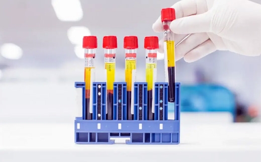 Comprehensive Fertility Tests